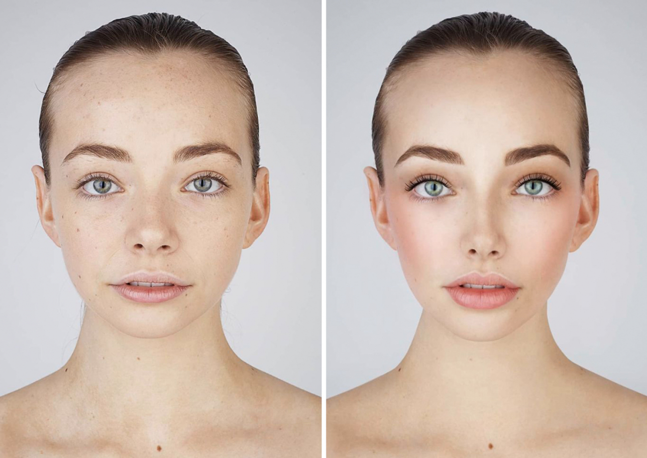 Galéria: Sokkoló felmérés: Ennyire megváltoztatnák arcukat a mai tinik