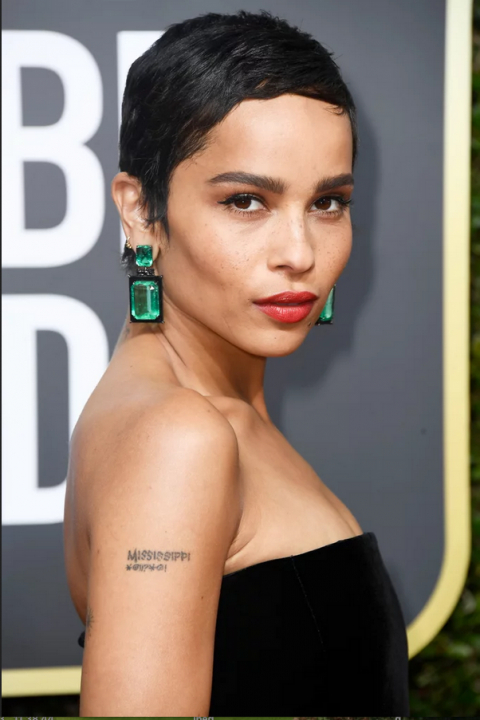 Galéria: Menő a szeplő!