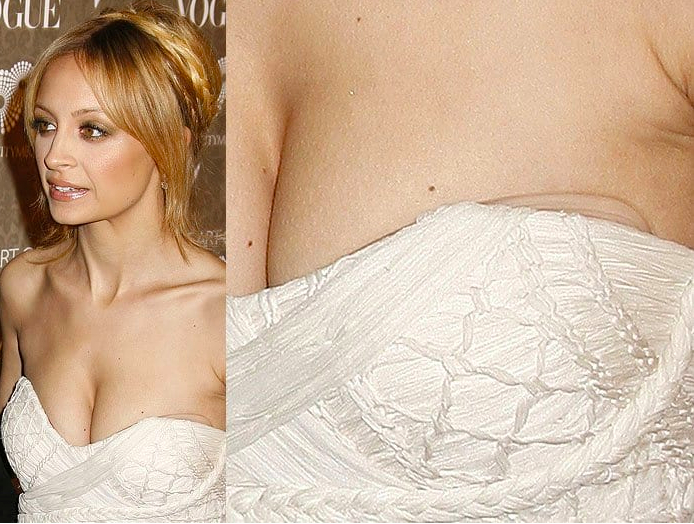 Galéria: Melltartóhelyettesítő opciók