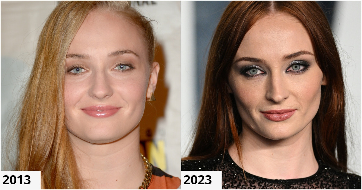 Galéria: Sztárok, akik teljesen átszabatták arcformájukat