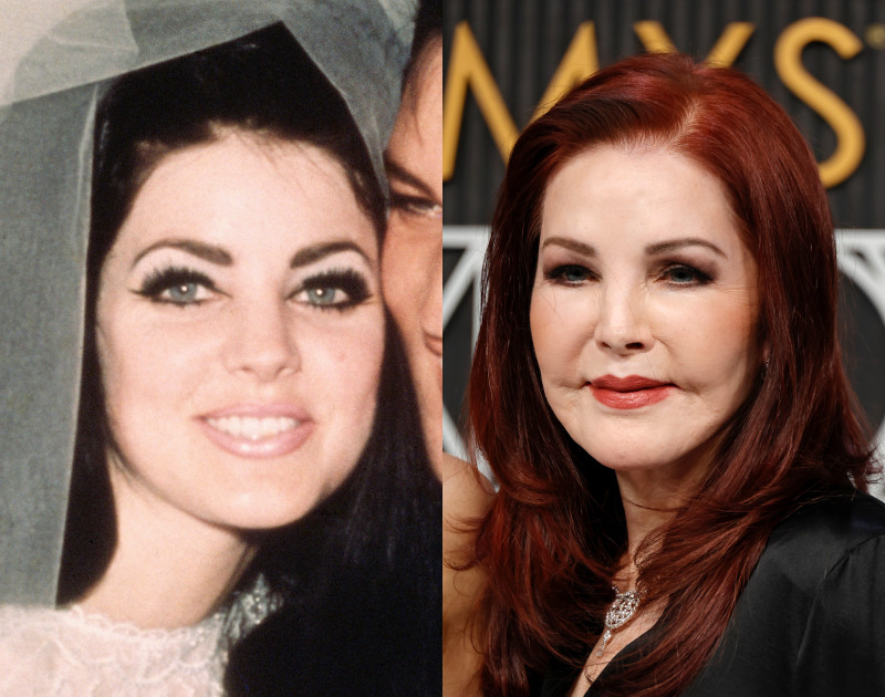 Galéria: Akkor és most fotók: 7 sztár, akit teljesen eltorzított a plasztika 