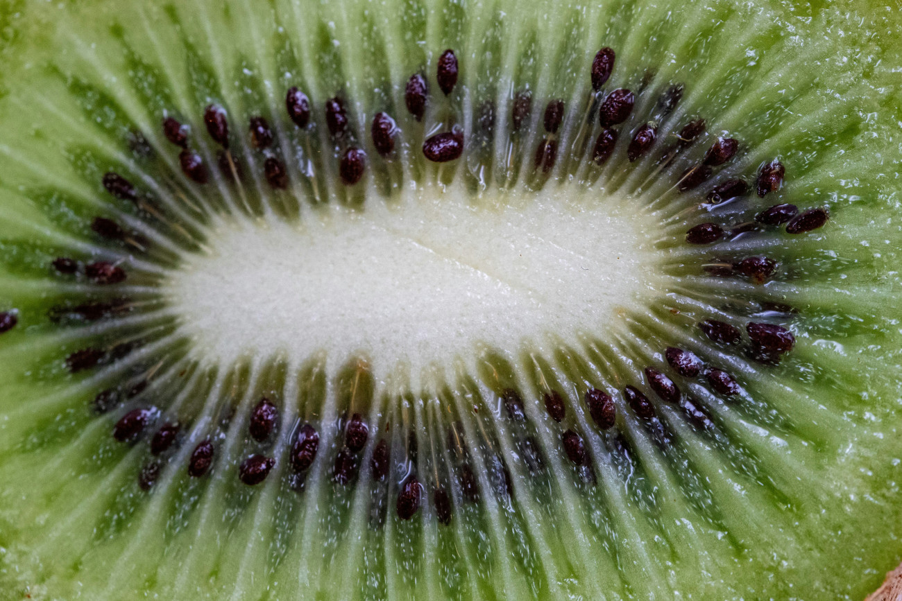 Galéria: A kivi 7 jótékony hatása az egészségre