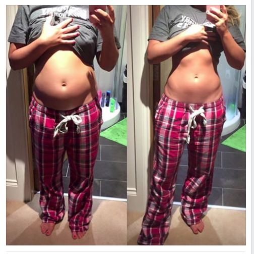 Galéria: 4 fitneszszemélyiség megmutatja, hogy még nekik is van pocakjuk