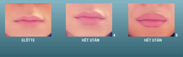 Kép