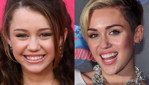 Borítókép: Ennyit számít a szép mosoly: Sztárok fogorvos előtt és után - FOTÓK