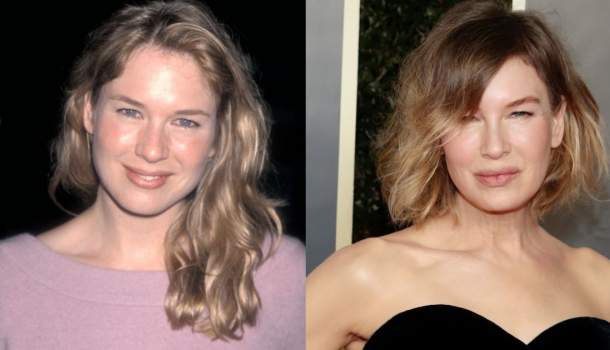 Borítókép: Szörnyű, mit tettek gyönyörű arcával a plasztikai sebészek: Így nézett ki Renée Zellweger 25 évvel ezelőtt!