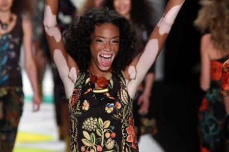 Borítókép: A szépség ezer arca: szupermodellek nem mindennapi külsővel