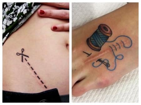 Borítókép: Elképesztő tetoválások, amelyek műtéti hegeket hivatottak elfedni