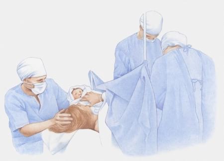 Borítókép: Csak erős idegzetűeknek! Anyuka brutál fotón szemlélteti, miért nem "megúszós" folyamat a császármetszés a természetes szüléshez képest