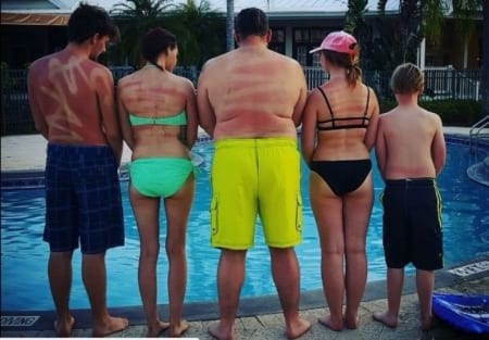 Borítókép: Jujj, ezt hogy csinálták? 12 durva minta, ahogyan le lehet égni a napon