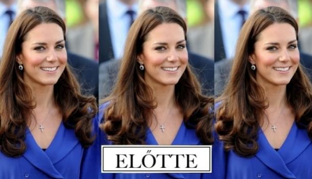 Borítókép: Csak ámulunk: Katalin hercegné haja még sosem volt ilyen rövid