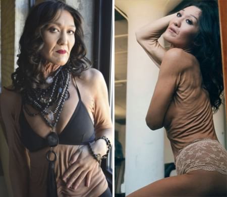 Borítókép: Ez a 26 éves nő eltökélten küzd azért, hogy megváltoztassa a szépségről formált véleményedet