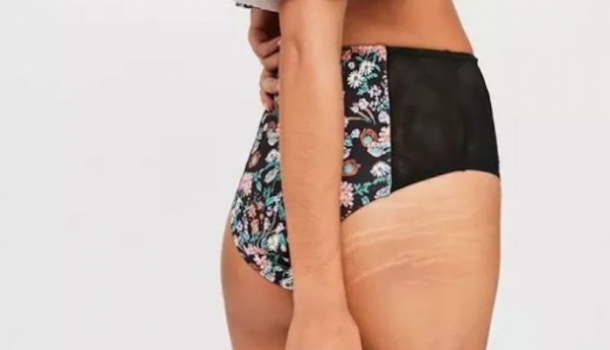 Borítókép: Újabb cég döntött úgy, hogy többé nem hazudik a vásárlóinak – Neked tetszenek a Photoshop-mentes fotók?