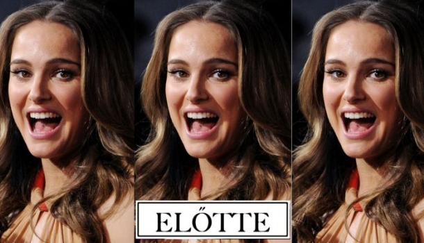 Borítókép: Sokk! Natalie Portman elképesztően rövidre vágatta a haját – FRISS FOTÓK