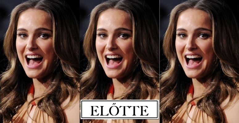 Sokk! Natalie Portman elképesztően rövidre vágatta a haját – FRISS FOTÓK