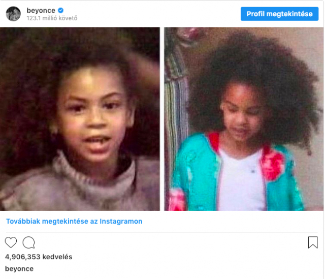 Beyoncé,Blue Ivy