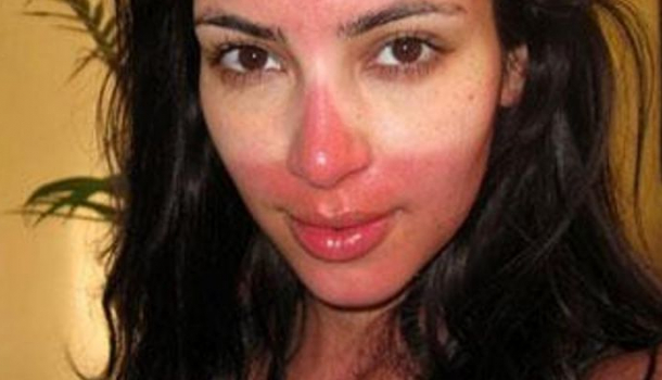 Borítókép: Ezeket a fürdőruhákat ne vedd fel ha, ha barnulni akarsz