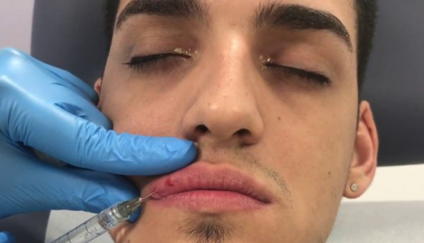 Borítókép: Egyre több férfi tölteti fel az ajkait