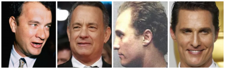 Borítókép: Híres férfiak, akik hajbeültetésen estek át