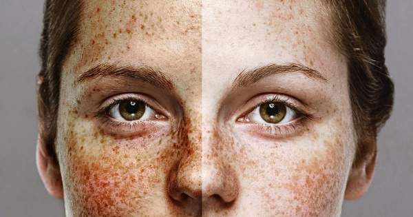 Borítókép: A legszexibb szépséghiba - ne rejtegesd!