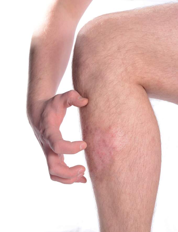 Kép