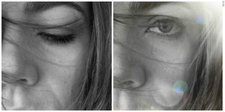 Borítókép: A bőrrákom után máig gyomorgörccsel megyek a szűrővizsgálatokra