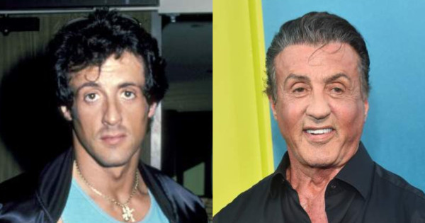 Borítókép: Férfi sztárok, akiket teljesen eltorzítottak a plasztikai műtétek