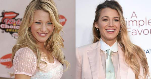 Borítókép: A kivételek! Avagy híres emberek, akiknek jót tett, hogy plasztikáztattak