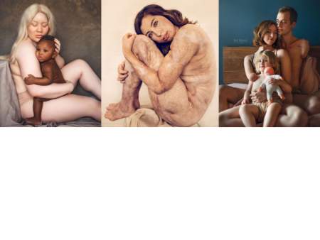 Borítókép: Sérülteket fotóz, hogy megmutassa 8 éves lányának; minden ember gyönyörű