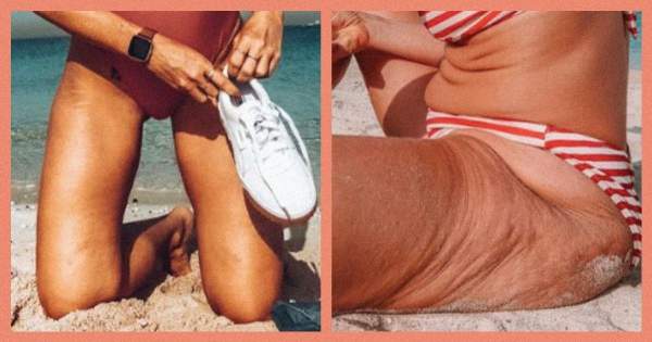 Borítókép: 10 bátor nő, aki bebizonyította, hogy minden test bikinitest