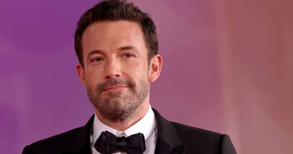 Borítókép: A kopaszodás őket sem kerülte el: 10 híres férfi, aki hajbeültetésen esett át