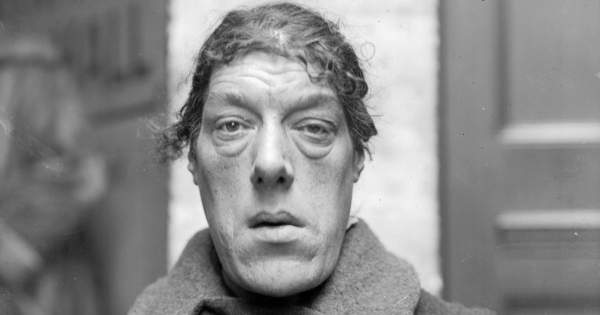 Borítókép: Amikor egy szép lélek egy torz külsőben ragad! Avagy a világ legcsúnyább nőjének szívszorító története