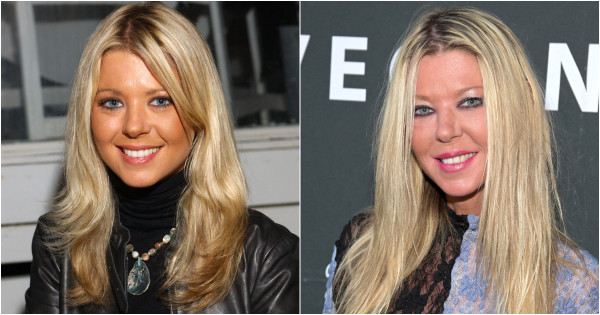 Borítókép: Alkoholfüggőség és plasztikai műtétek sora: sztárok, akiknek szépségén nyomot hagyott az elmúlt 20 év