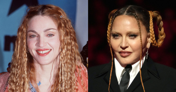 Borítókép: Akkor és most fotók Madonnáról - félelmetes, hogyan tették felismerhetetlenné arcát a plasztikai sebészek