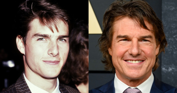 Borítókép: Tényleg a plasztikai műtétek miatt torzult el az arca? Akkor és most fotók, amik megmutatják, mennyit változott Tom Cruise az évek során