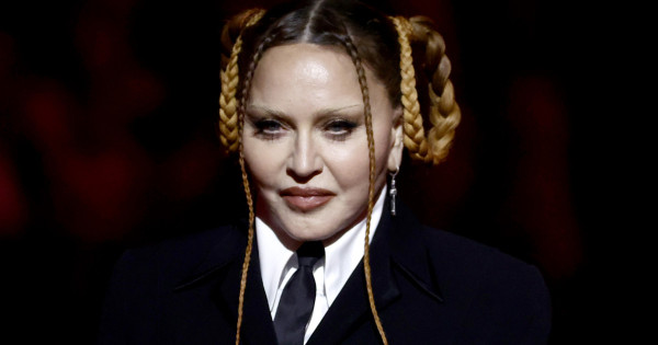 Borítókép: Lement a duzzanat Madonna arcáról: olyan, mint 20 évesen