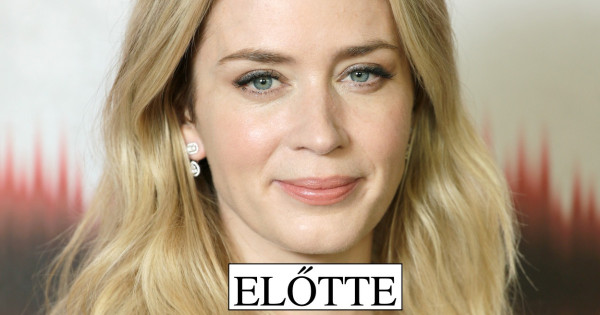 Borítókép: „Úristen, ez nem lehet ő!” - Plasztikával vádolják a 40 éves Emily Blunt színésznőt: szerinted jogosan?