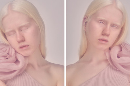 Borítókép: 11 éves albínó ikrek forgatták fel a divatvilágot