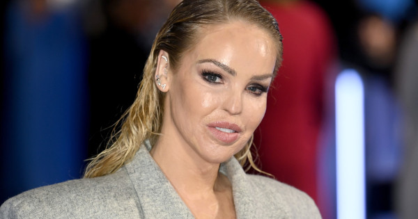 Borítókép: Fél szemére megvakult, amikor bántalmazó exe savval öntötte le, ma a világ egyik leghíresebb motivációs trénere - Katie Piper inspriáló története