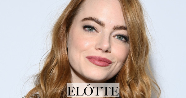Borítókép: Emma Stone új frizurája a bizonyíték: mennyit képes változtatni egy nő kisugárzásán egy kis hajvágás