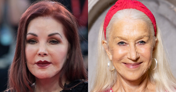 Borítókép: Híres nők, akik bár egykorúak, a plasztikai beavatkozások miatt a köztük lévő különbség ég és föld 