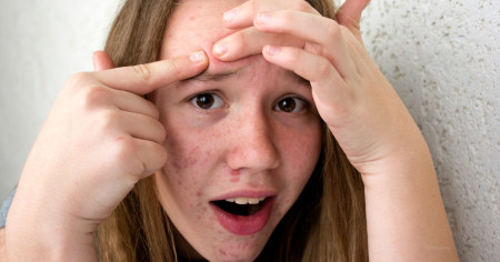 Borítókép: Szőrtelenítés, sminkelés, dezodorozás: mikortól ideális és hogyan készítsük fel a gyerekeket, hogy ne tragédiaként éljék meg a testi változásokat?