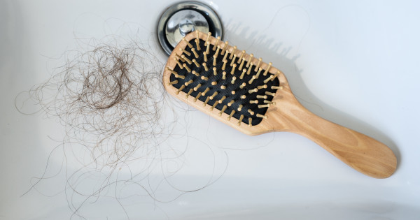 Borítókép: Hajhullás, zsíros bőr? 8 jellegzetes tünet, ami hormonzavarra utalhat