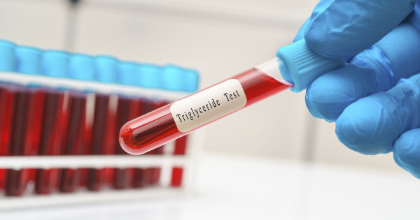 Borítókép: 8 étel, ami csökkenti a vérzsírt, ezzel meghosszabbítva életed: szíved hálás lesz ezekért!