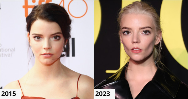 Borítókép: 7 sztár, aki teljesen átformálta arccsontját - És nem feltétlenül előnyére