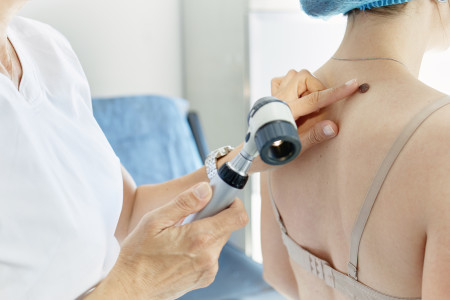 Borítókép: 7 elváltozás az anyajegyen, amit ha meglátsz, azonnal fordulj orvoshoz: akár rák is lehet 