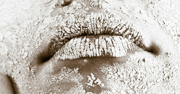 Borítókép: A száraz bőr 7 meglepő oka: nem csupán a széltől és a hidegtől jelentkezhetnek a kellemetlen tünetek