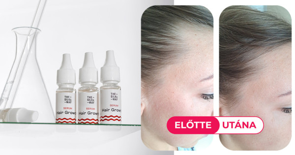 Borítókép: Ezzel a kúrával már 8 hét alatt búcsút mondhatsz a hajhullásnak – Mit tud a TheSilkyWay hajhullás csökkentő termékcsaládja?