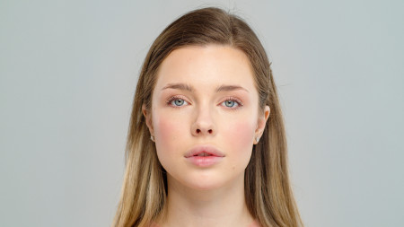 Borítókép: Piros foltok és vörös hajszálerek az arcon? Nem csak a hideg, betegség is okozhatja a kellemetlen tüneteket!