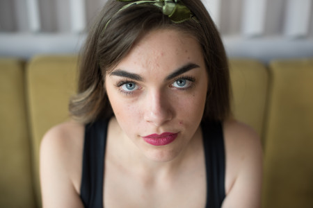 Borítókép: 7+1 élelmiszer, ami belülről betegíti meg a bőrödet: nem csak a csokoládé okozhat gondot!